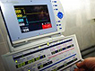 Marca CE para primer sistema mundial de ultrasonido clínico de ultra alta frecuencia