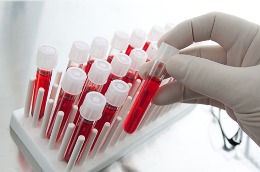 Image: Hologic is selling its share of the Procleix blood-screening business to Grifols (Photo courtesy of iStock).