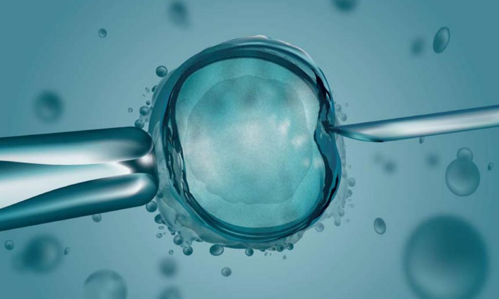 TradeMed Industry News Global Volume of IVD Procedures Exceeds 21