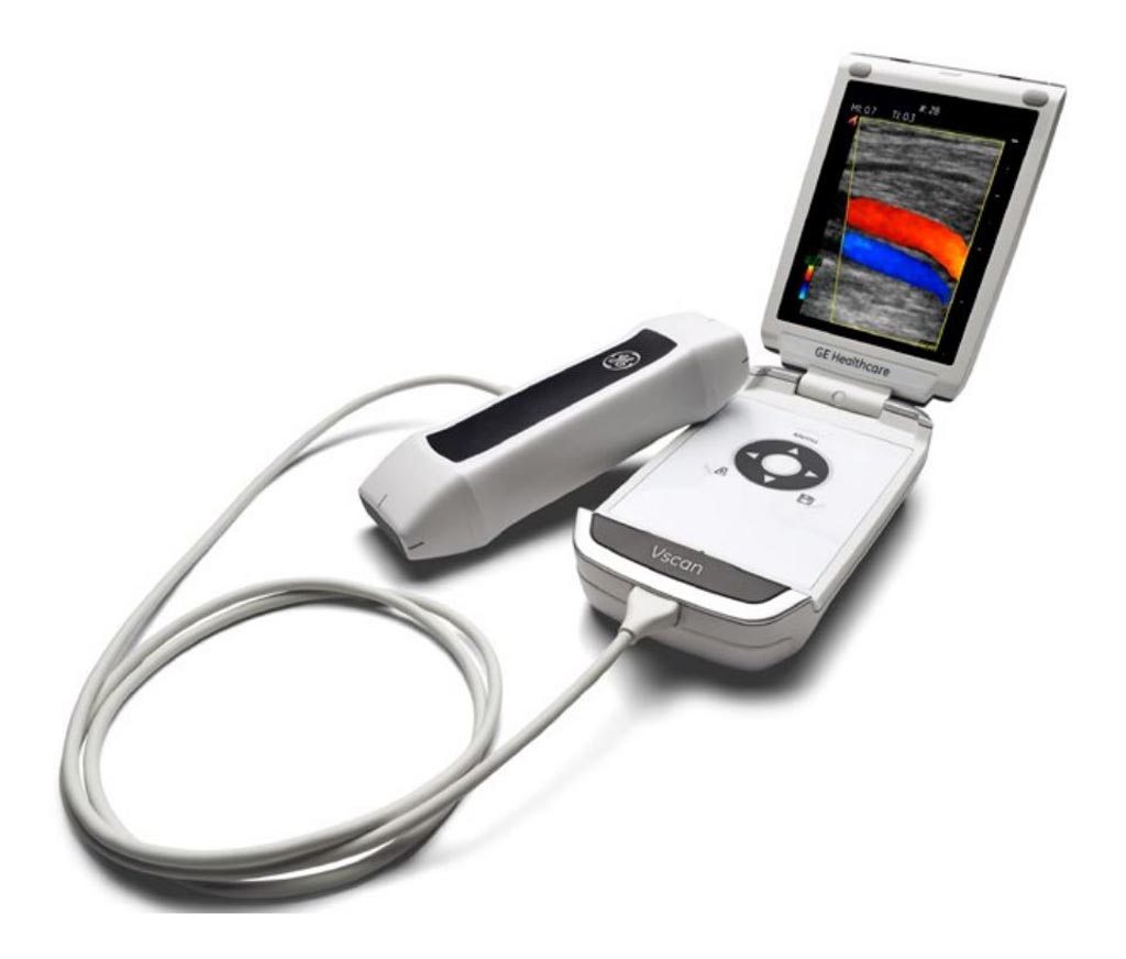 Image: The Vscan portable ultrasound scanner (Photo courtesy of GE Healthcare).