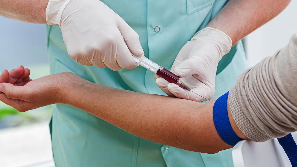 TradeMed Industry News Blood Test Uses AI To Detect Peripheral 