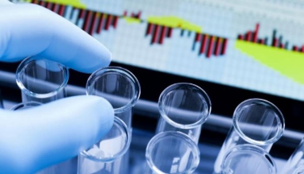 TradeMed Noticias de la industria LaboratoryDeveloped Tests Market