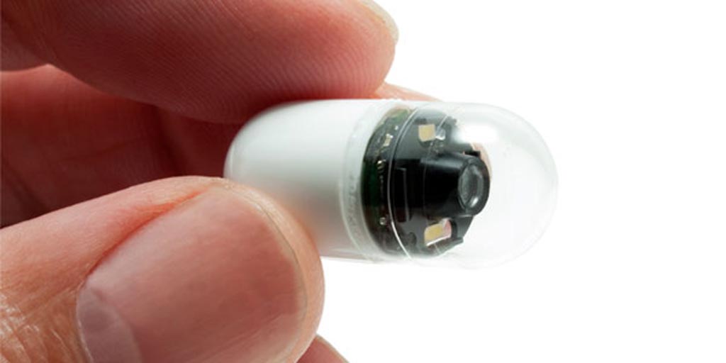 TradeMed Industry News Smart Pills Market Worth USD 3 Billion by 2025 Medical Equipment