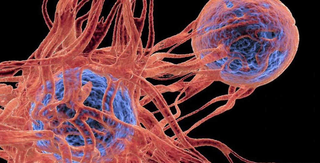 Image: A new AI tool can predict the severity of three common symptoms faced by cancer patients (Photo courtesy of SPL).