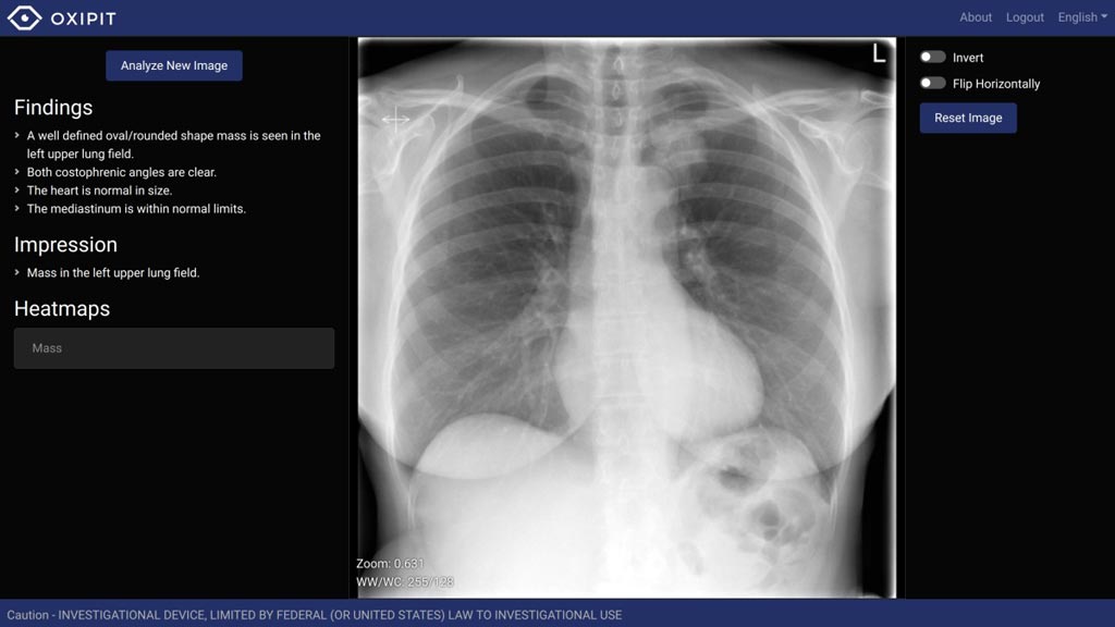 TradeMed Industry News AI based Software for Chest X rays Receives