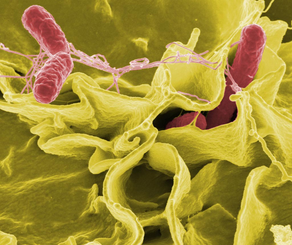 Imagen: La plataforma Respuesta del Huésped al Análisis Microbiano se puede adaptar a diferentes patógenos, incluida la Salmonella enterica (Fotografía cortesía de Wikipedia).