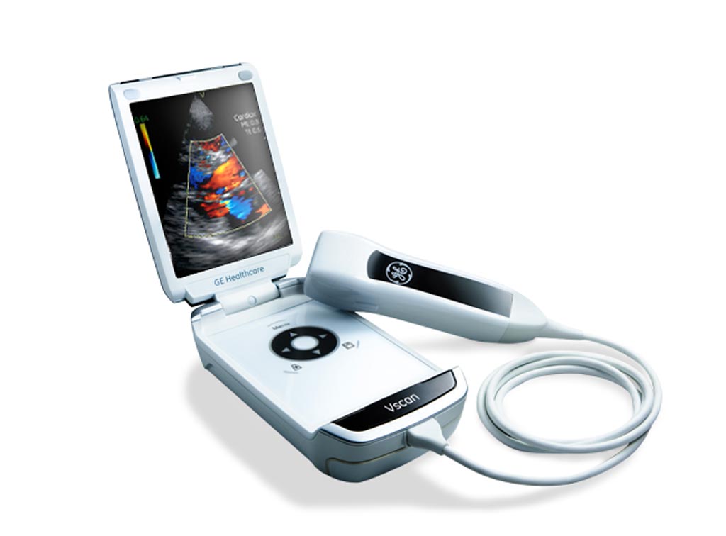 TradeMed Industry News Global Portable Ultrasound Devices Market to