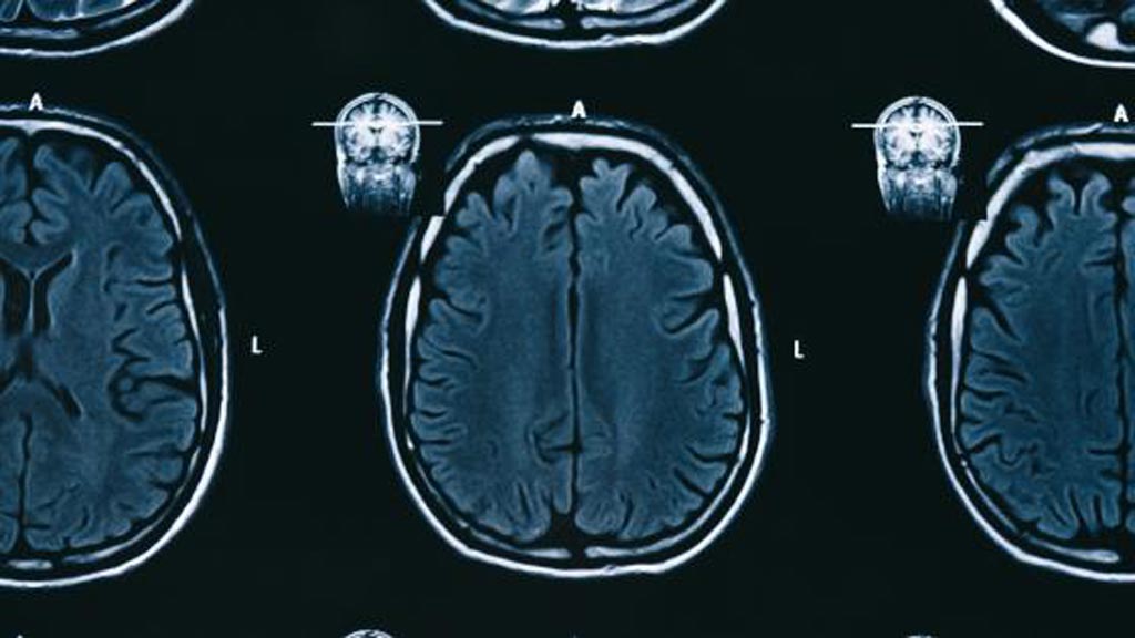 Image: Subtle Medical’s AI product SubtleGAD reduces the gadolinium needed during MRI exams without sacrificing diagnostic quality (Photo courtesy of iStock).