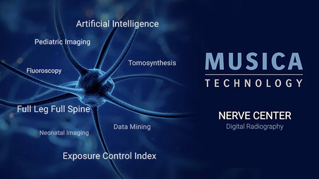 Imagen: El MUSICA Nerve Center ofrece un flujo de trabajo orientado al cliente y características potentes e innovadoras (Fotografía cortesía de Agfa HealthCare).
