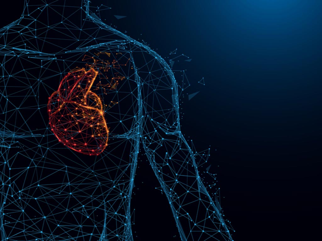 Image: AutocathFFR, a fully automated system, is designed to detect stenoses (narrowing) in the coronary arteries surrounding the heart (Photo courtesy of MedHub).