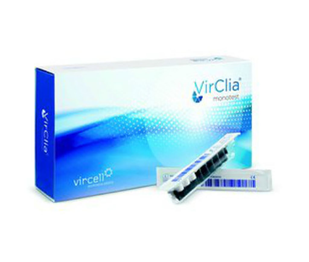 Image: COVID?19 VIRCLIA® IgG Monotest (Photo courtesy of Vircell S.L.)