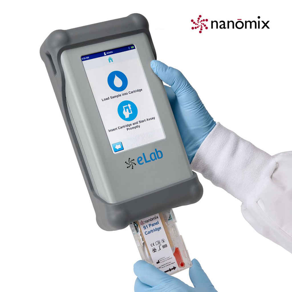 Image: Nan?mix eLab is a mobile, hand-held immunoassay and chemistry diagnostic system (Photo courtesy of Nanomix)