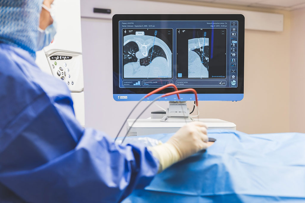 Image: IMACTIS CT-Navigation System is designed for CT-guided percutaneous interventions (Photo courtesy of IMACTIS)