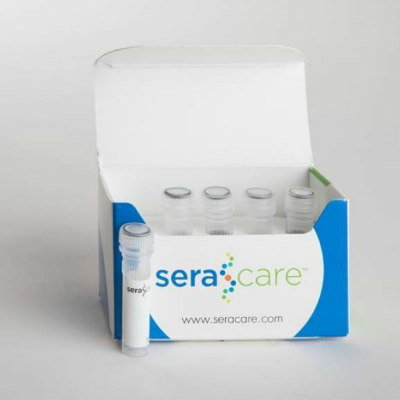 SARS-COV-2，流感A / B和RSV分子控制套件