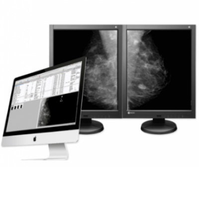 Mammography Workstation