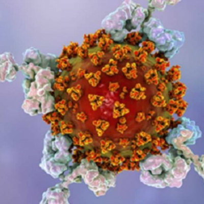 SARS-COV-2 IgG ELISA测试