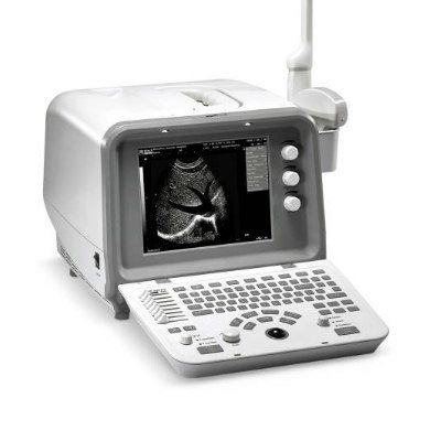 Digital Ultrasound Machine