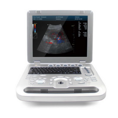 颜色多普勒超声诊断系统