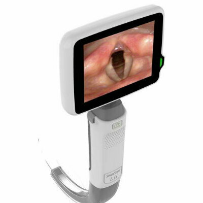 Digital Video Laryngoscope