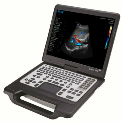 Portable Color Doppler Ultrasound