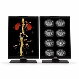 Diagnostic Radiology Monitor