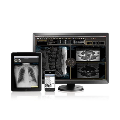 Sante DICOM Viewer Pro 12.2.5 download the new