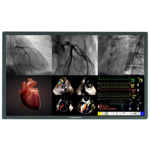Monitor HybridPixx Medical Equipment and devices for hospitals or