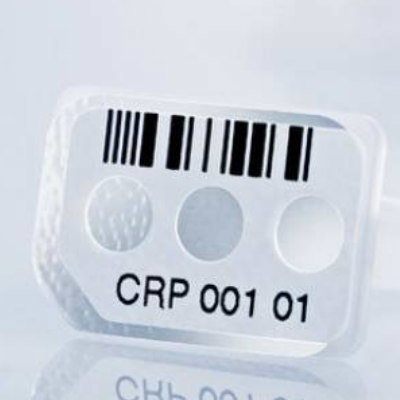 c反应蛋白测试