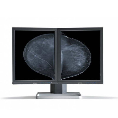 Mammography Display