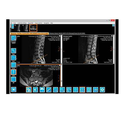 Sante DICOM Viewer Pro 12.2.5 for iphone download