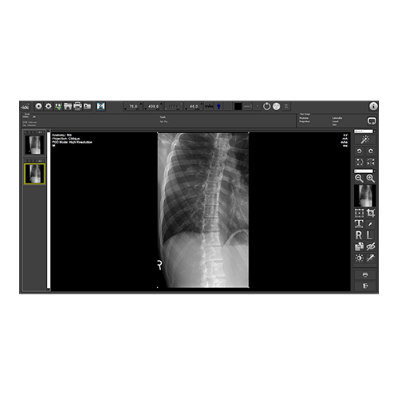 Medical Image Processing Software