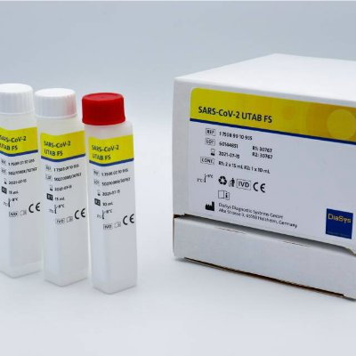SARS-CoV-2抗体测试
